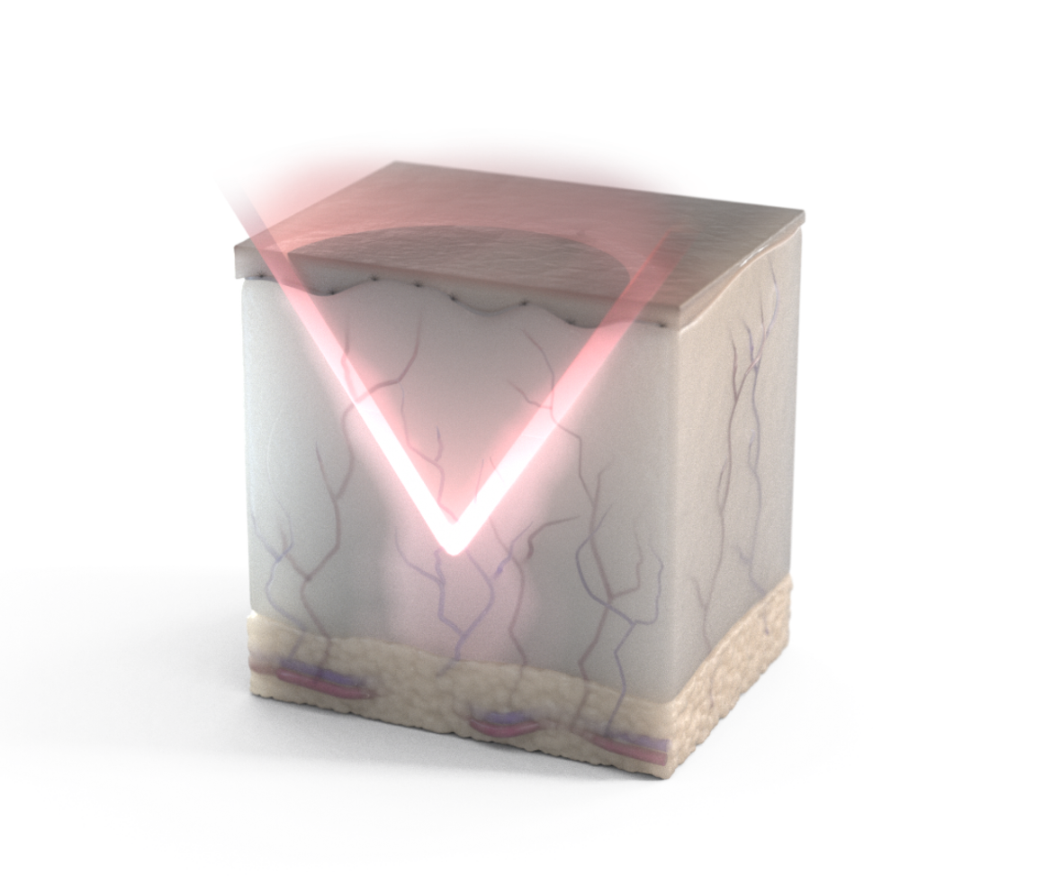 focal-point